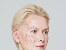 Нитевые методы омоложения АПТОС