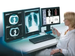 Цифровая рентгенография: преимущества и возможности современной технологии в медицине
