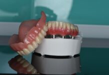 Съемные протезы на имплантатах: преимущества, виды и особенности использования