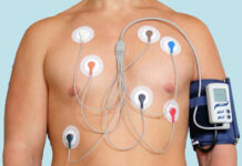 ЭКГ по Холтеру: особенности проведения, результаты и возможные ошибки