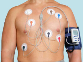 ЭКГ по Холтеру: особенности проведения, результаты и возможные ошибки