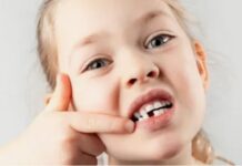 Примерные сроки выпадения молочных зубов у детей