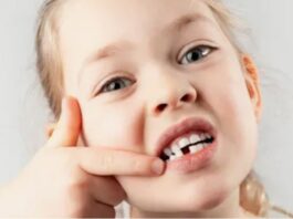 Примерные сроки выпадения молочных зубов у детей